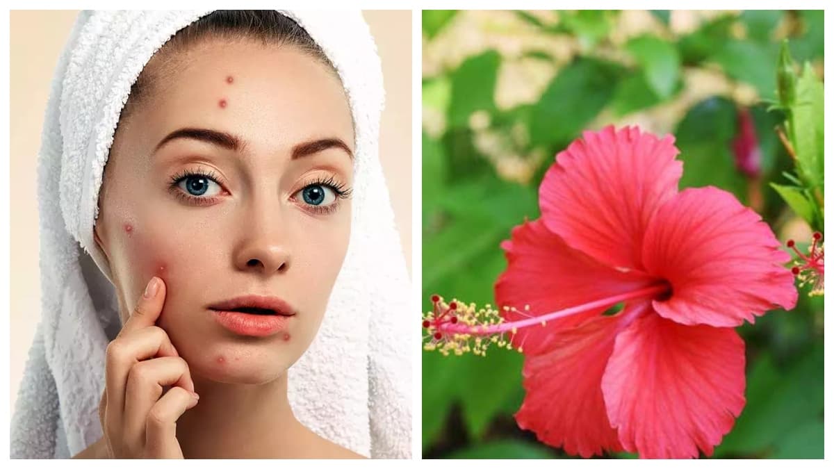 Beauty Tips: गुड़हल के फूलों का इस्तेमाल, नेचुरल ग्लो इनके फेस पैक के साथ