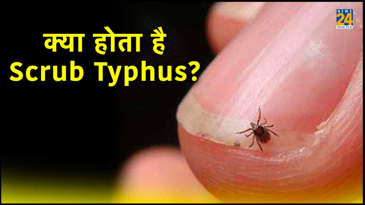 क्या है 'Scrub Typhus' और कैसे फैलती है ये बीमारी? Odisha में गई 8 लोगों की जान