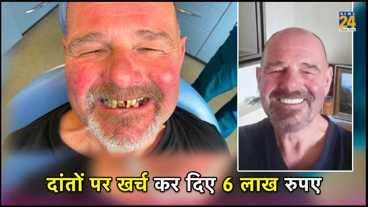 50 सालों तक नहीं मुस्कुराया शख्स, पैरों के नाखून जैसे हो गए थे दांत