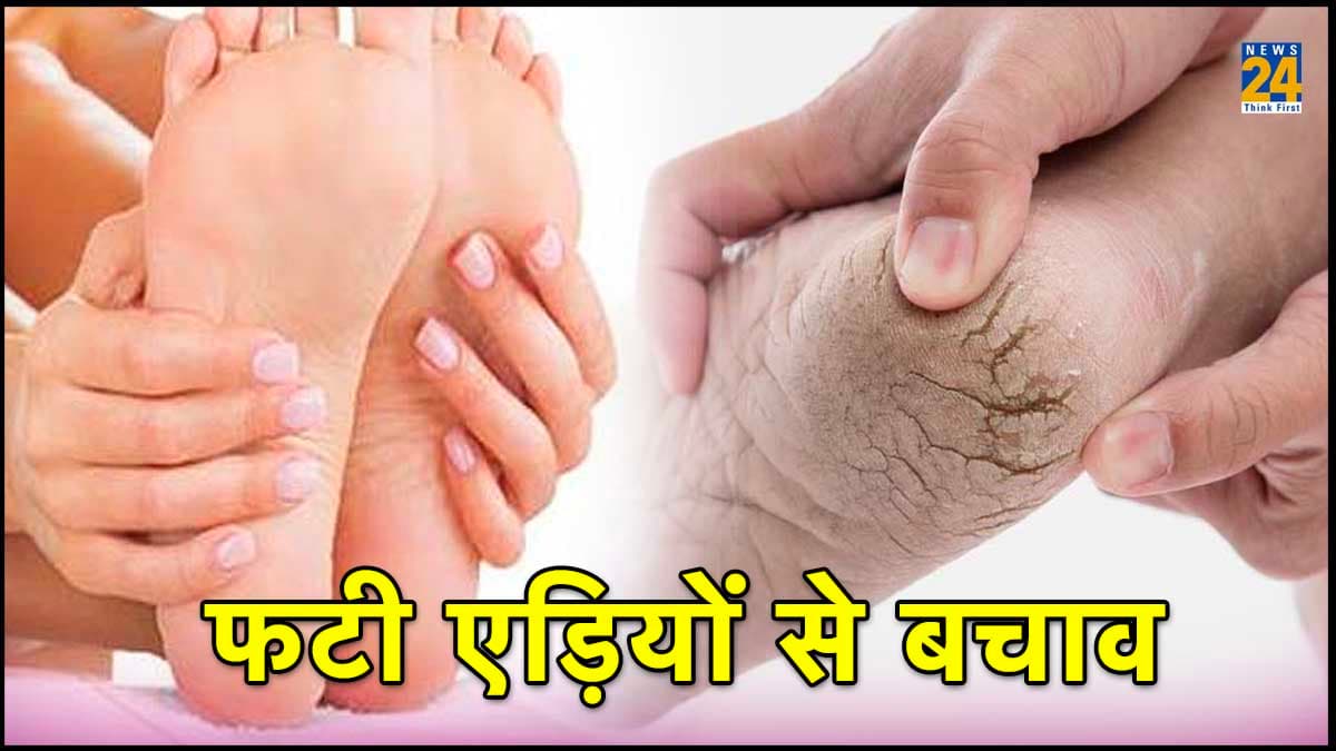 सर्दी में फटी एड़ियों का उपचार, इन 4 घरेलू नुस्खों को अपनाएं और आसानी के साथ आराम पाएं