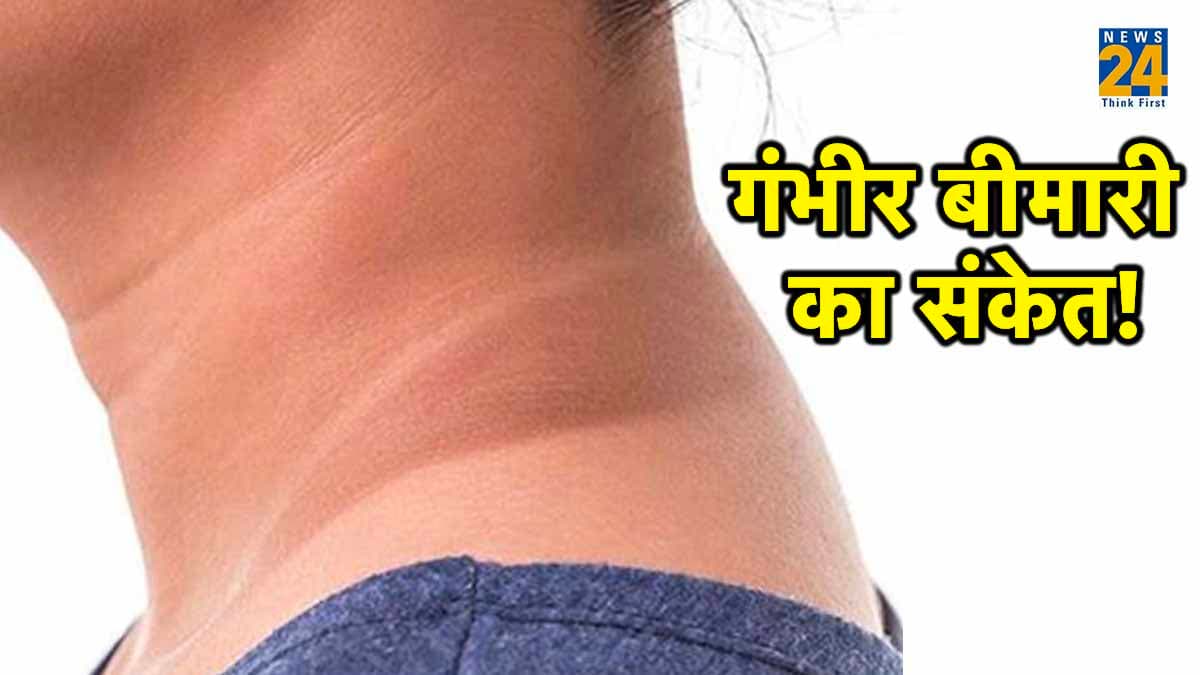 नजरअंदाज न करें गर्दन का कालापन! बन सकता है 4 बीमारियों का कारण