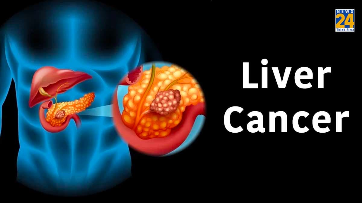 Primary Liver Cancer क्या है? कैसे पहचानें इसके शुरुआती संकेत और लक्षण, जानें