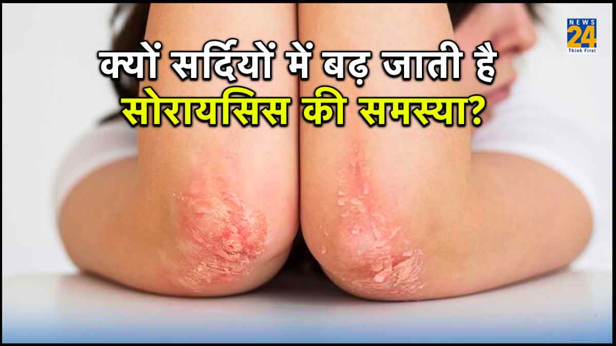 सर्दियों में क्यों बढ़ती है सोरायसिस की समस्या? जानिए लक्षण, प्रकार और इलाज