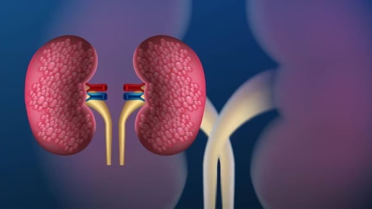 Gallstones Vs Kidney Stones दोनों ही एक बीमारियां, कैसे लगाएं पता पथरी किस में है?