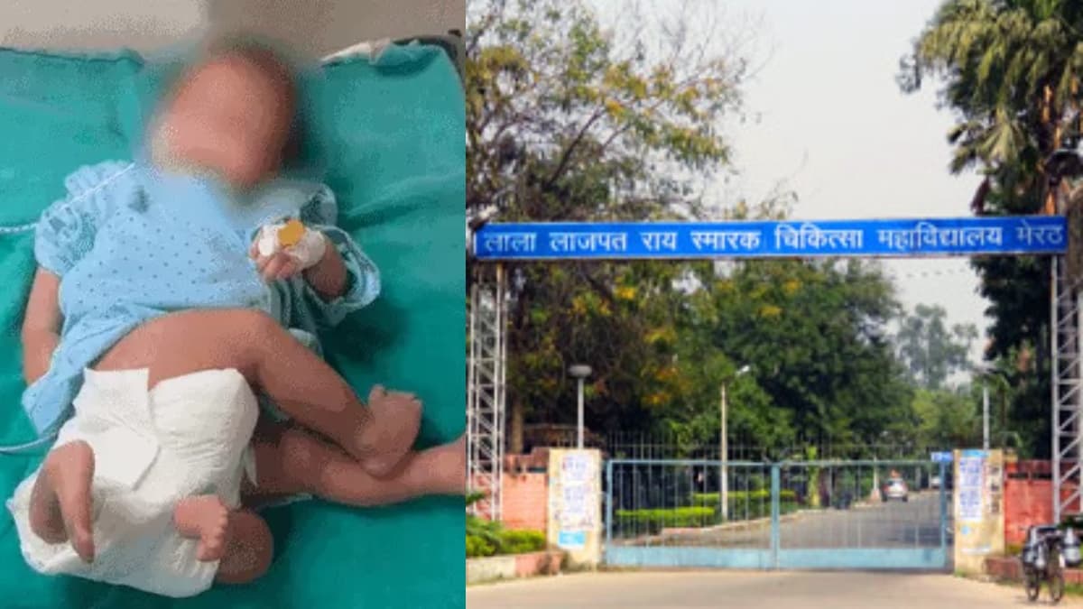 4 हाथ-पैर वाला 'चमत्कारी बच्चा'! पैदा होते ही डॉक्टर के पास भागी मां, विशेषज्ञों ने इस अद्भुत घटना के पीछे की बताई वजह