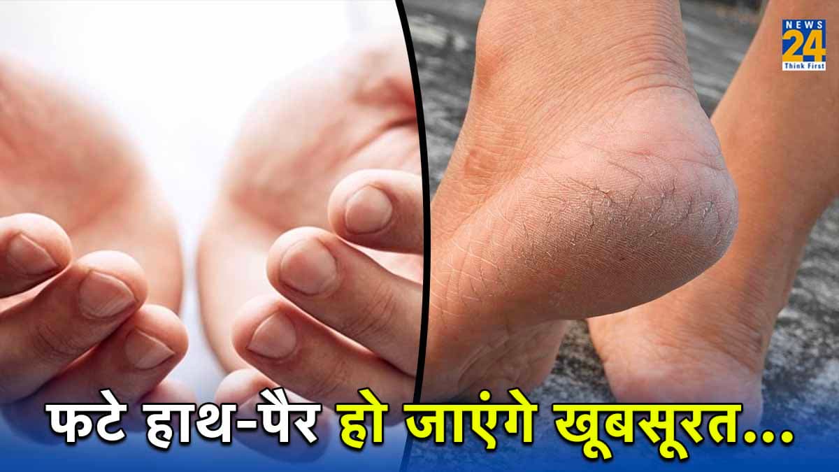 Winters में फट जाते हैं हाथ-पैर, अपनाएं दादी-नानी के 5 नुस्खे
