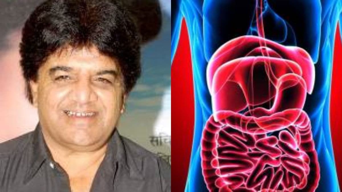 Actor Junior Mehmood: जूनियर महमूद की मौत की वजह पेट का कैंसर! बहुत आम हैं शुरुआती लक्षण