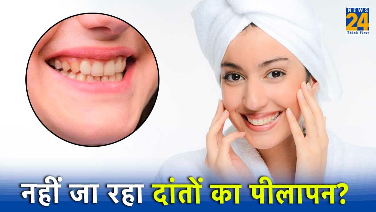 रोजाना दांत साफ करने पर भी नहीं जा रहा दांतों का पीलापन? विटामिन की कमी है कारण!