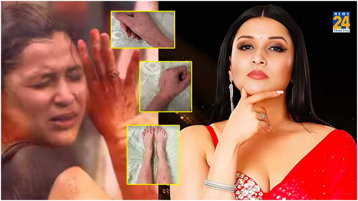 मिर्ची टास्क की कीमत अभी तक चुका रहीं Mannara Chopra, एक्ट्रेस का हाल देख उड़ जाएंगे होश