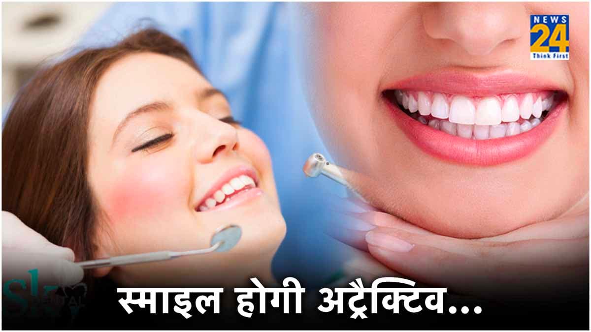 क्या है Smile Designing? कैसे होती है और कितना आता है खर्च?