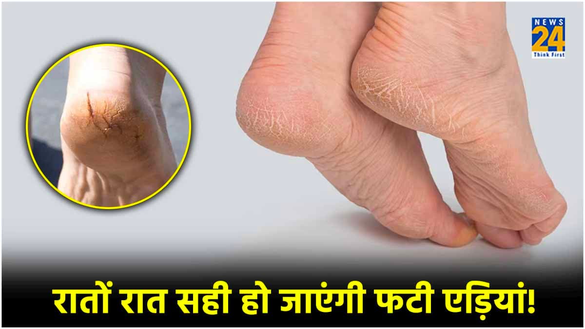 फटी एड़ियों से मिलेगा छुटकारा, बस सरसों के तेल में मिला दें ये एक चीज