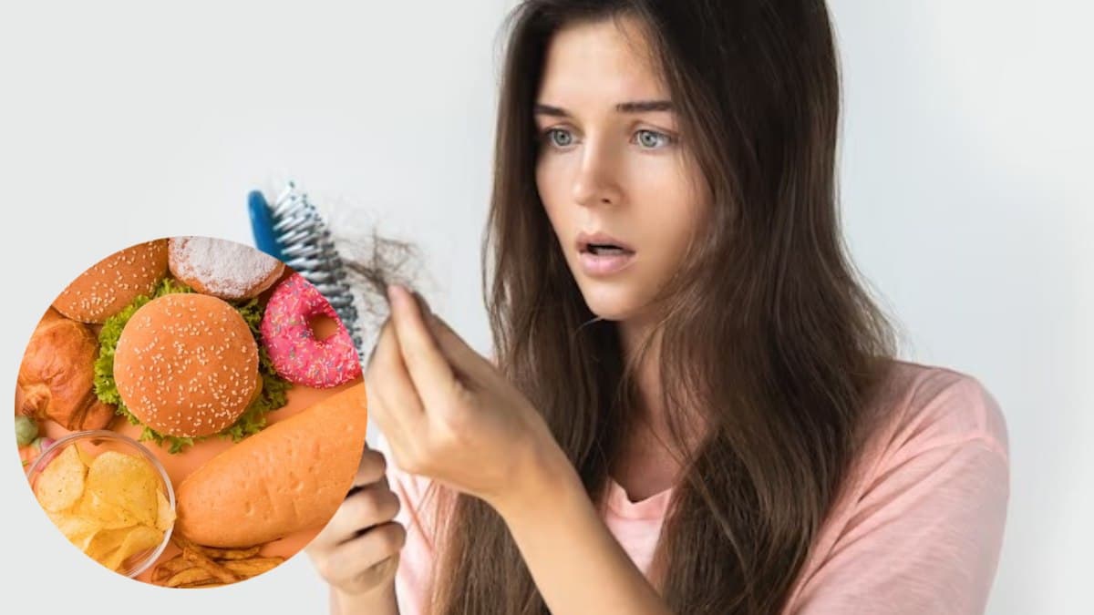 क्या झड़ने लगे हैं आपके भी बाल? ये 6 Foods हो सकते हैं वजह