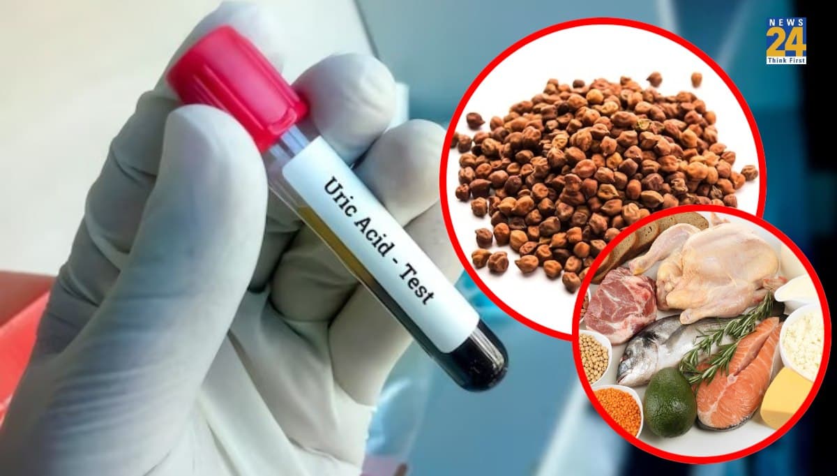 high uric acid level