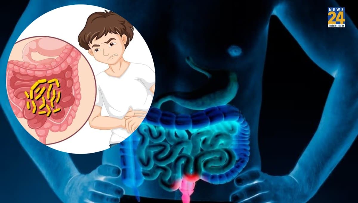 आंतों की सफाई जरूरी, इन 6 घरेलू नुस्खों से होगी सालों से जमी गंदगी साफ!
