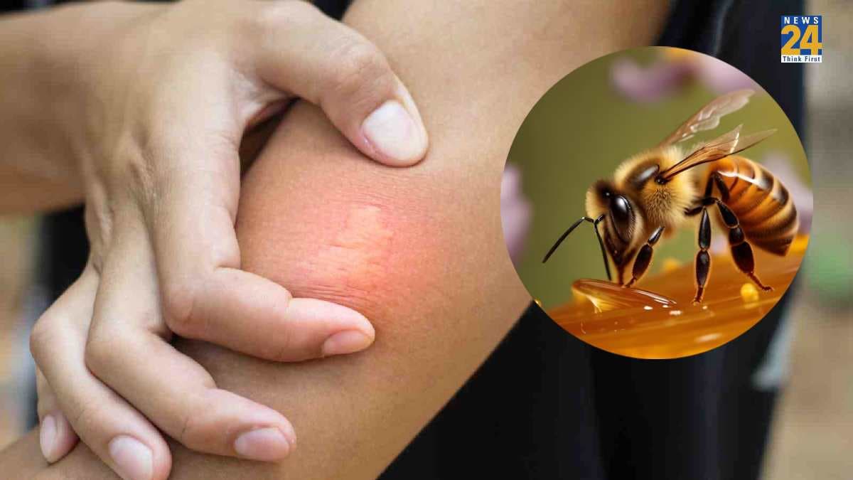 मधुमक्खी के काटने पर दर्द और सूजन नहीं हो रही कम? तो अपनाएं ये 5 घरेलू नुस्खे
