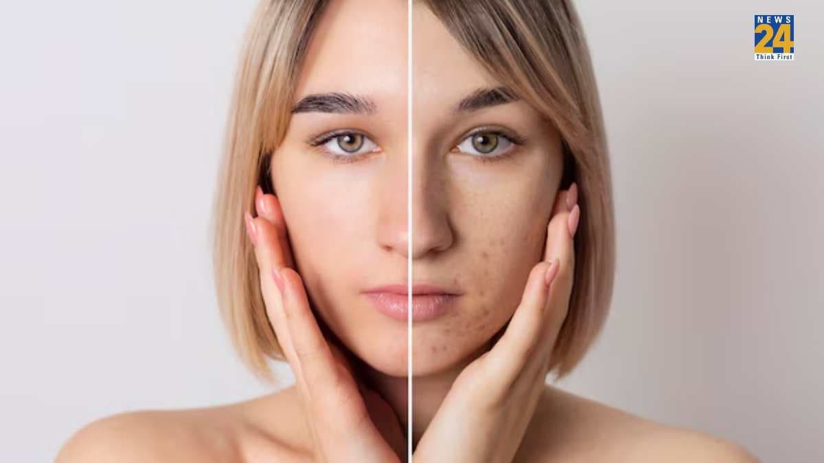 Home Remedies For Open Pores: चेहरे पर दिख रहे हैं ओपन पोर्स तो अपनाकर देखें रसोई के ये 5 घरेलू नुस्खे
