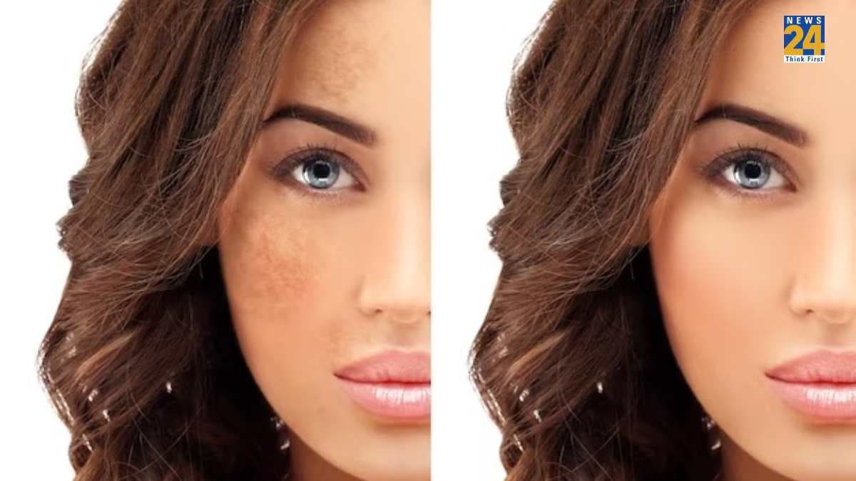 Home Remedies: हफ्तेभर में चेहरे की झाइयां होंगी उड़नछू, बस आजमाएं ये 7 घरेलू नुस्खे