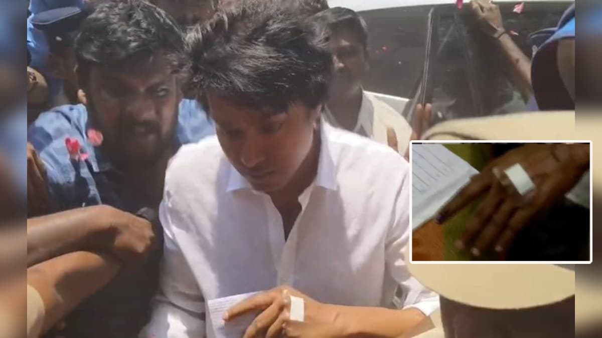 Thalapathy Vijay के हाथों और सिर पर दिखी चोट, तस्वीरें देख घबराए फैंस