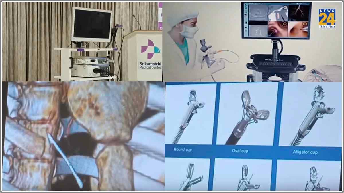 चमत्कार या कमाल! डॉक्टरों ने की अनोखी सर्जरी; साढ़े 3 मिनट में निकाली लड़की के फेफड़े में फंसी 4CM लंबी सूई