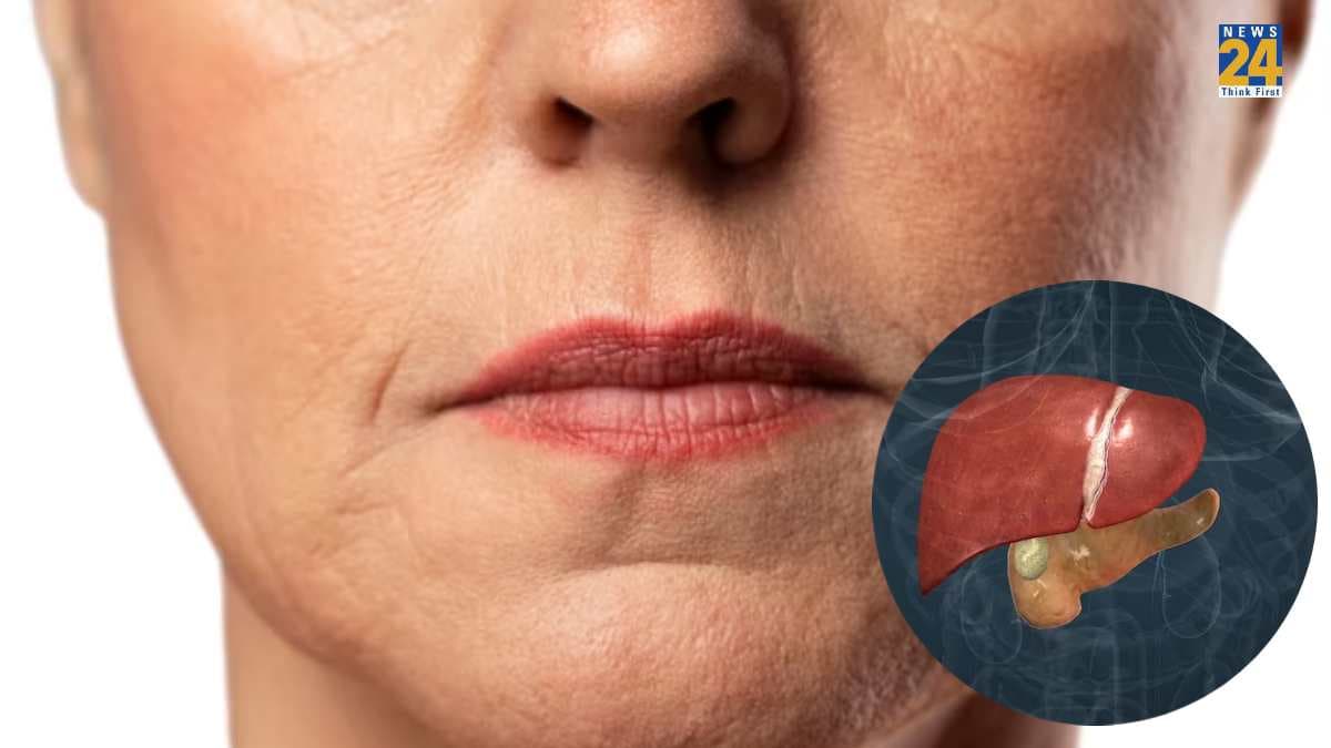 Liver Damage होने से पहले चेहरे पर दिखते हैं 5 संकेत