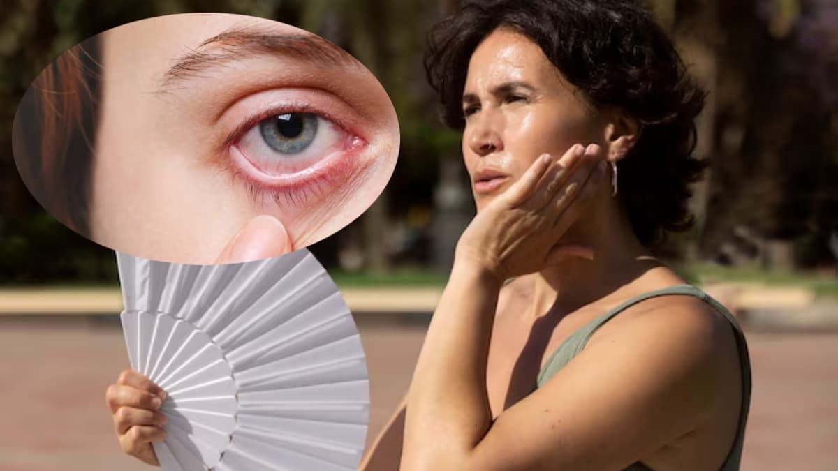 अब पसीना ले सकता है आपकी आंखों की रोशनी! क्या कहते हैं Experts