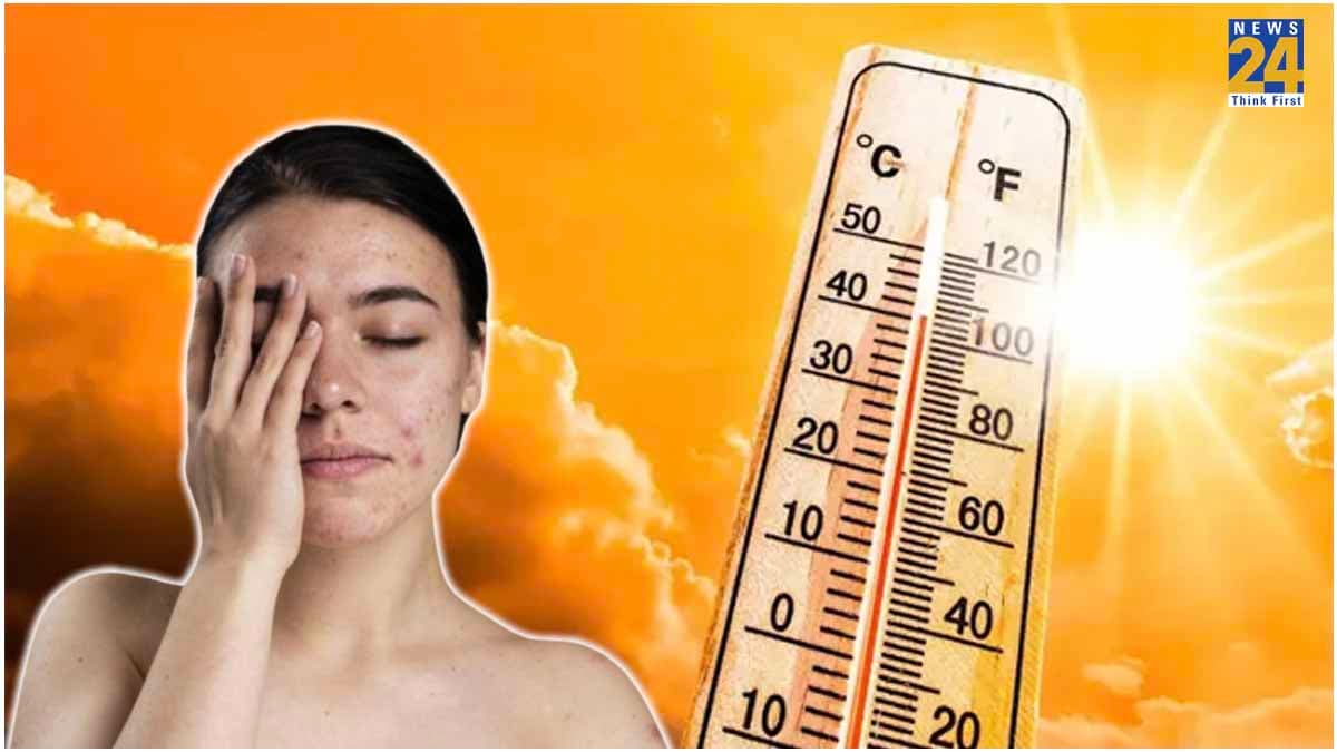 तपती गर्मी से कौन सी स्किन प्रॉब्लम्स और बचाव के उपाय, कब रंग बदलती है त्वचा?