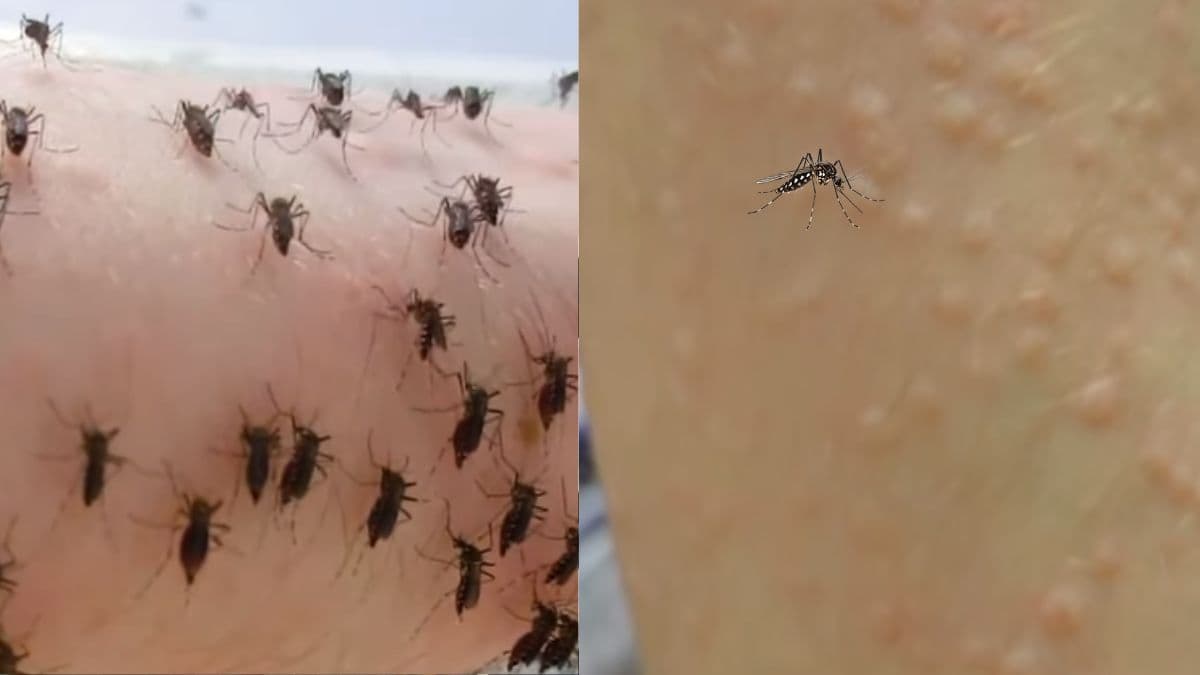 Mosquitoes Attack