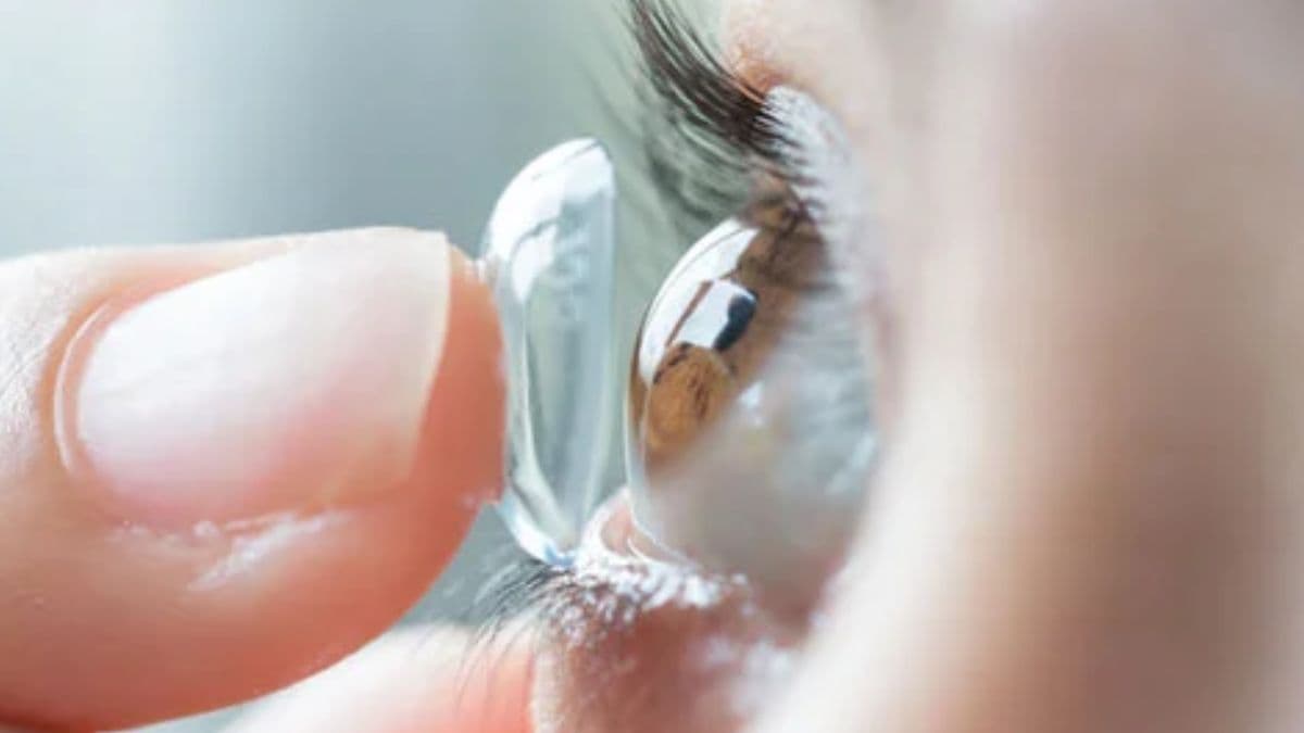 Acanthamoeba keratitis