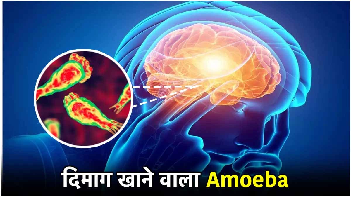 Brain-eating amoeba