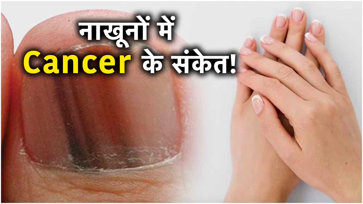 नाखून से भी मिलते हैं कैंसर के संकेत, रिसर्च में सामने आई ये बात