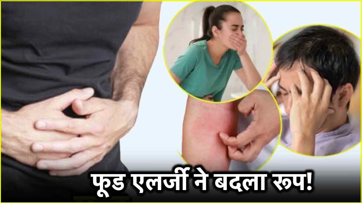 ये 5 संकेत बताते हैं कि आपको फूड एलर्जी है, जानें क्यों होती है बीमारी? कैसे करें बचाव