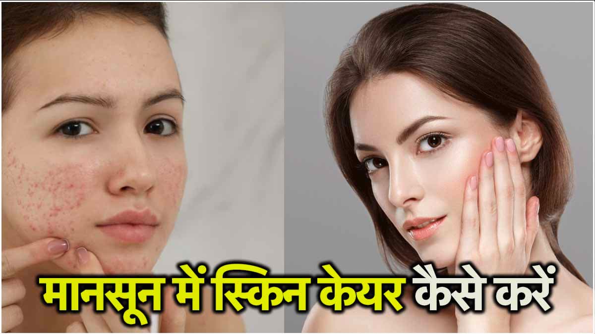 मानसून में स्किन केयर के लिए इन 5 बातों का रखें ध्यान, नहीं होगी इंफेक्शन की संभावना