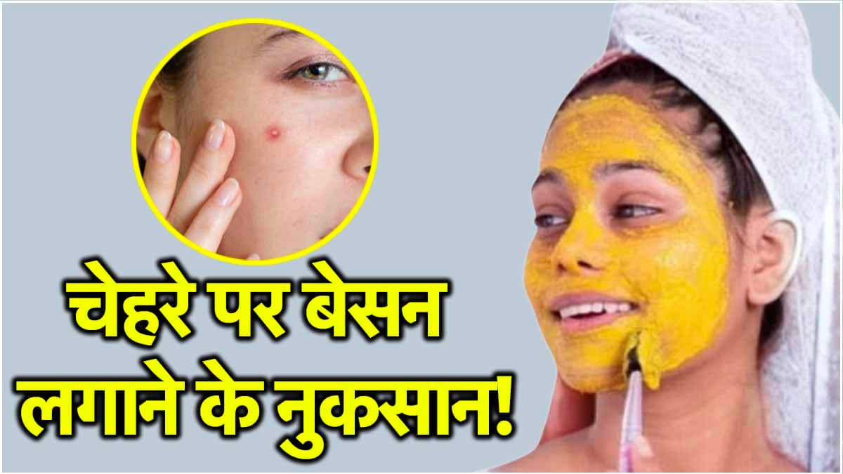 चेहरे पर बेसन लगाने के 4 साइड इफेक्ट, कहीं ग्लोइंग स्किन पर पिंपल्स न हो जाएं