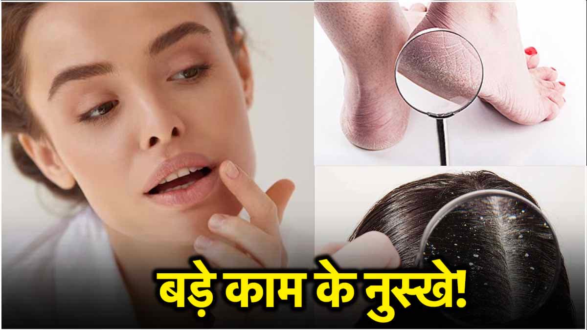 सिर्फ 5 रुपये में बढ़ाएं सिर से लेकर पैरों की खूबसूरती, ये हैं 3 रामबाण घरेलू नुस्खे!