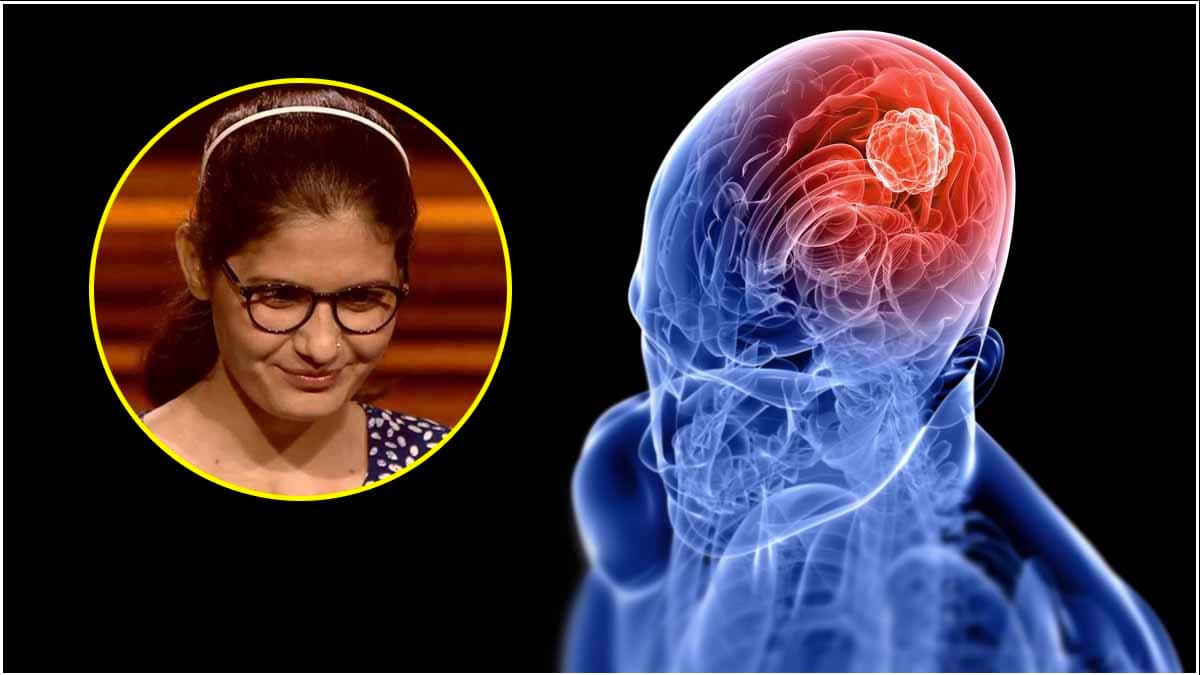 Brain Tumor से पीड़ित है KBC 16 की ये कंटेस्टेंट, जानें इस बीमारी के शुरुआती संकेत