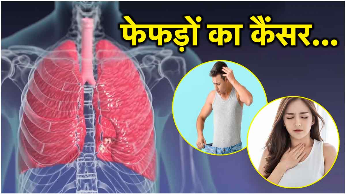 Lung Cancer Day: फेफड़ों के कैंसर के 7 संकेत को न करें इग्नोर; जानें लक्षण और बचाव