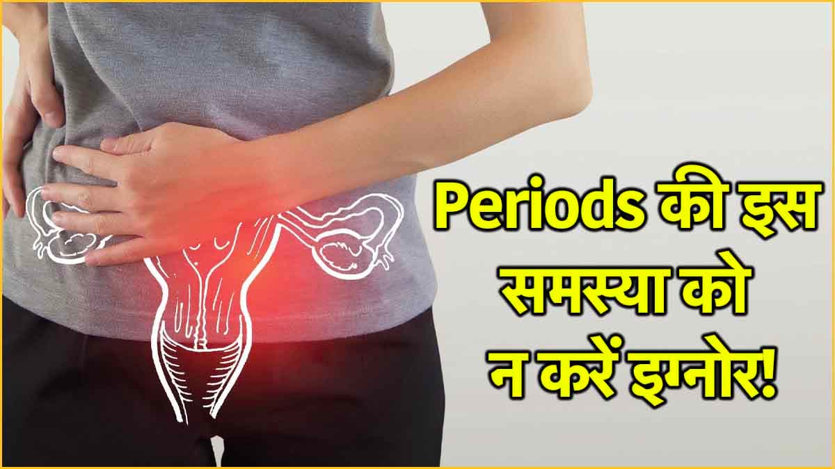 PCOS से 70% महिलाएं परेशान! Regular Periods के बाद भी हैं कई शिकार- WHO