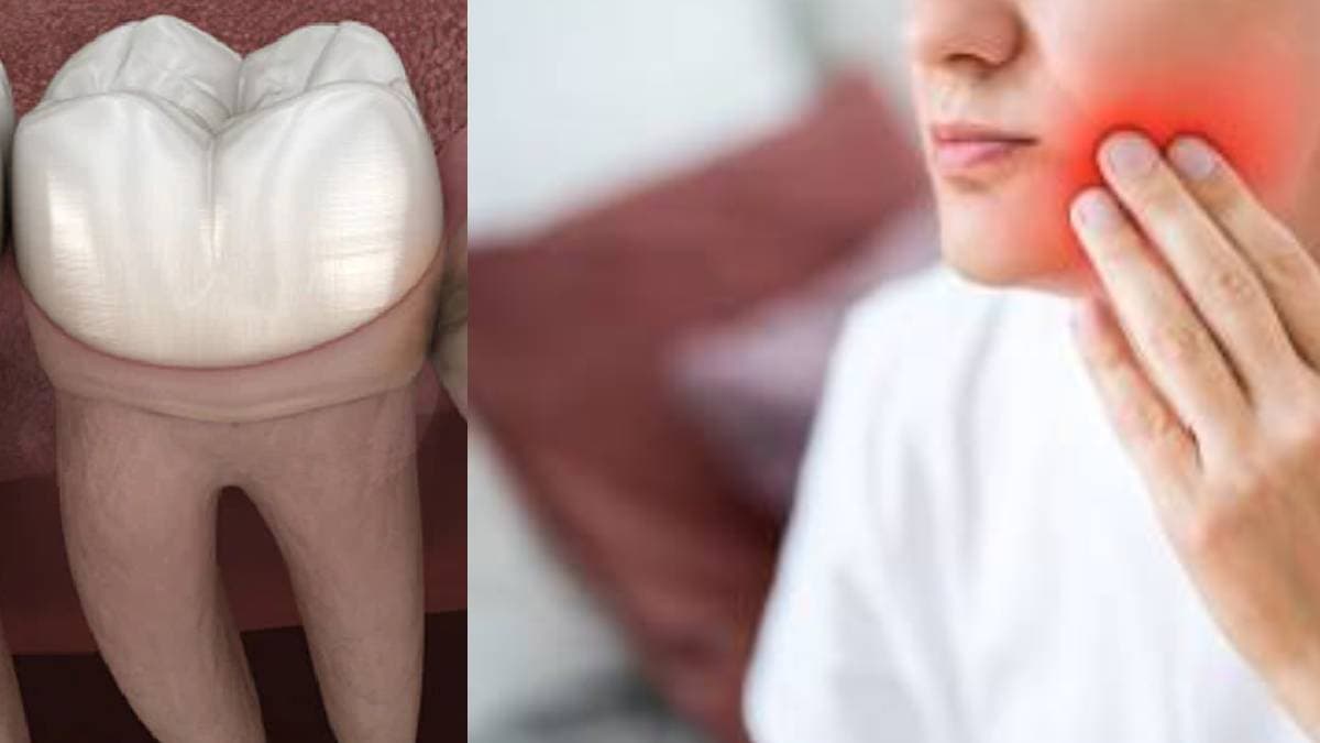 Dentist ने 4 साल नहीं दी अपॉइटमेंट, दारू पी और हथौड़े से खुद ही निकाल लिया दांत, कौन है ये शख्स?