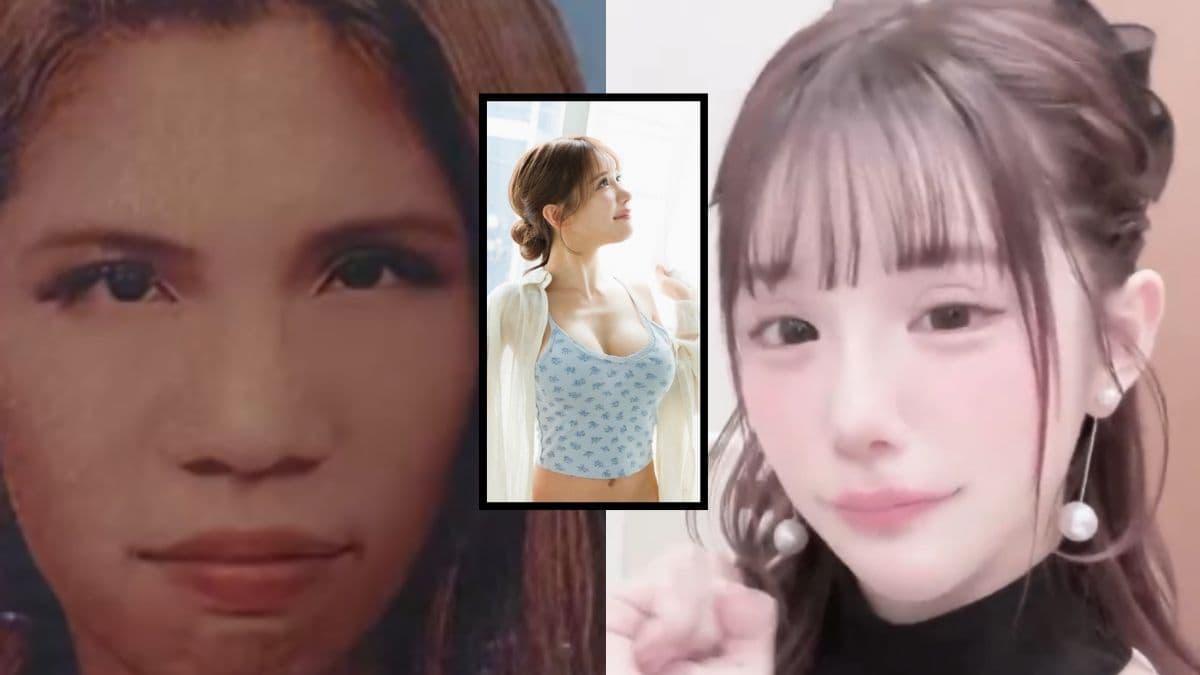 चेहरे और ब्रेस्ट की 20 सर्जरी, खूबसूरत दिखने के लिए खर्च किए करोड़ रुपये, नया लुक देखकर दुनिया हैरान