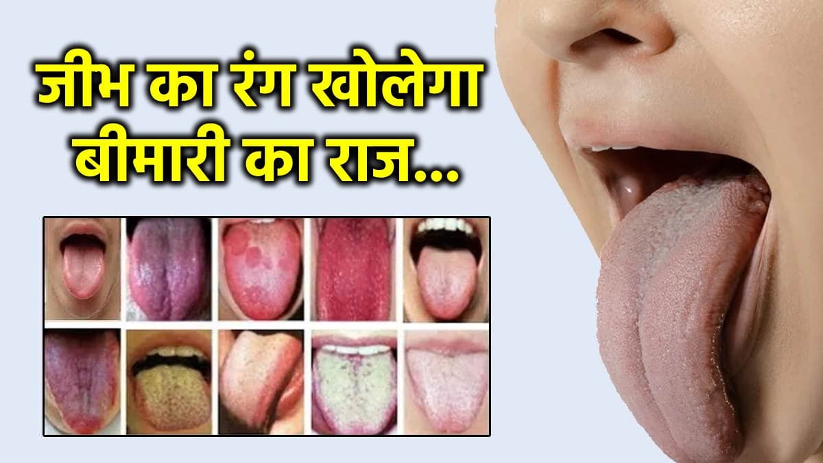 Tongue Colour: जीभ का रंग खोलेगा आपकी सेहत का राज, नीला रंग है खतरे का निशान