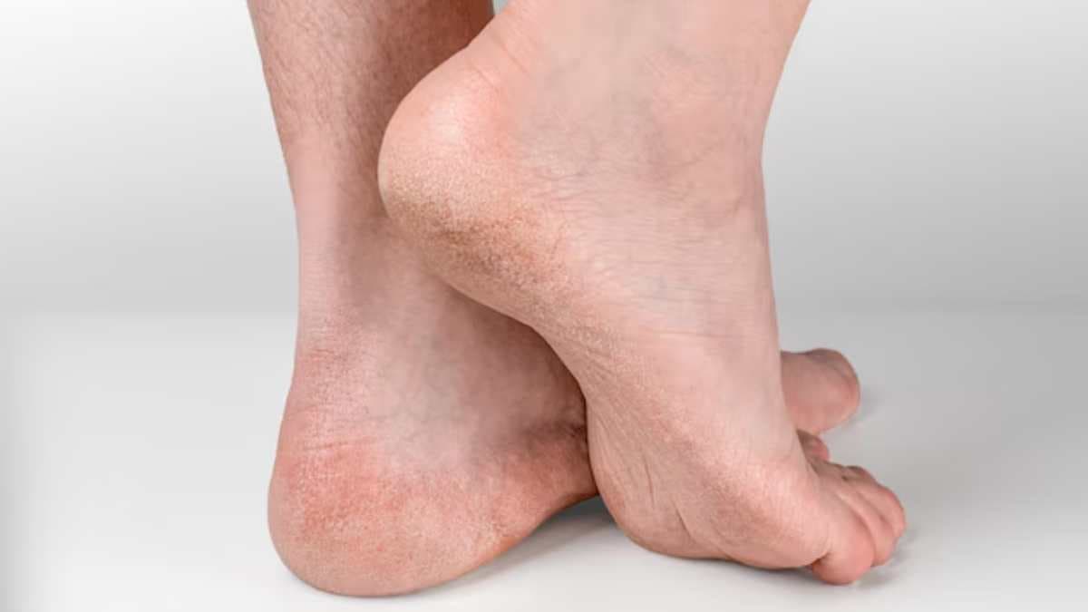 Feet Signs: फटी एड़ियां-ठंडे पैर, ऐसे संकेतों को कभी न करें नजरअंदाज, हो सकती है गंभीर बीमारी
