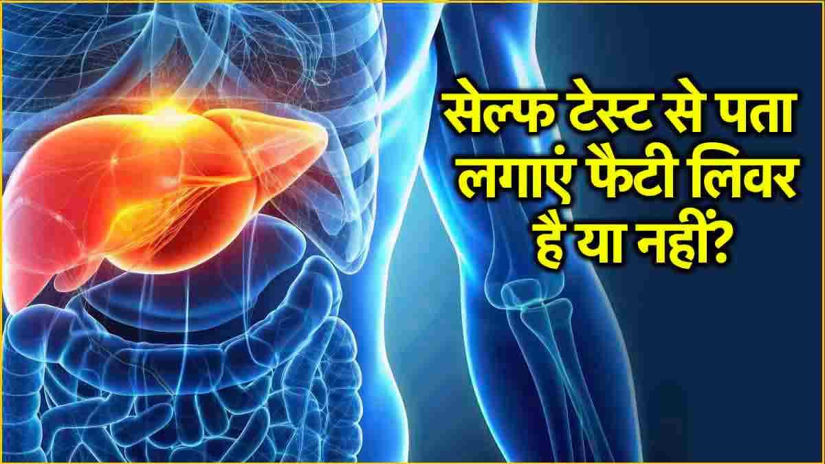 फैटी लिवर का घर पर ऐसे करें टेस्ट; डॉक्टर ने बताए तरीके, कहीं आप तो नहीं शिकार?