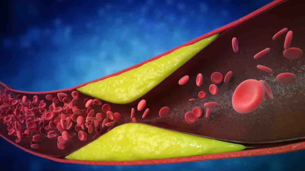 सर्दियों में Cholesterol कम करने के लिए खाएं ये सब्जियां, डायटीशियन ने गिनाए फायदे