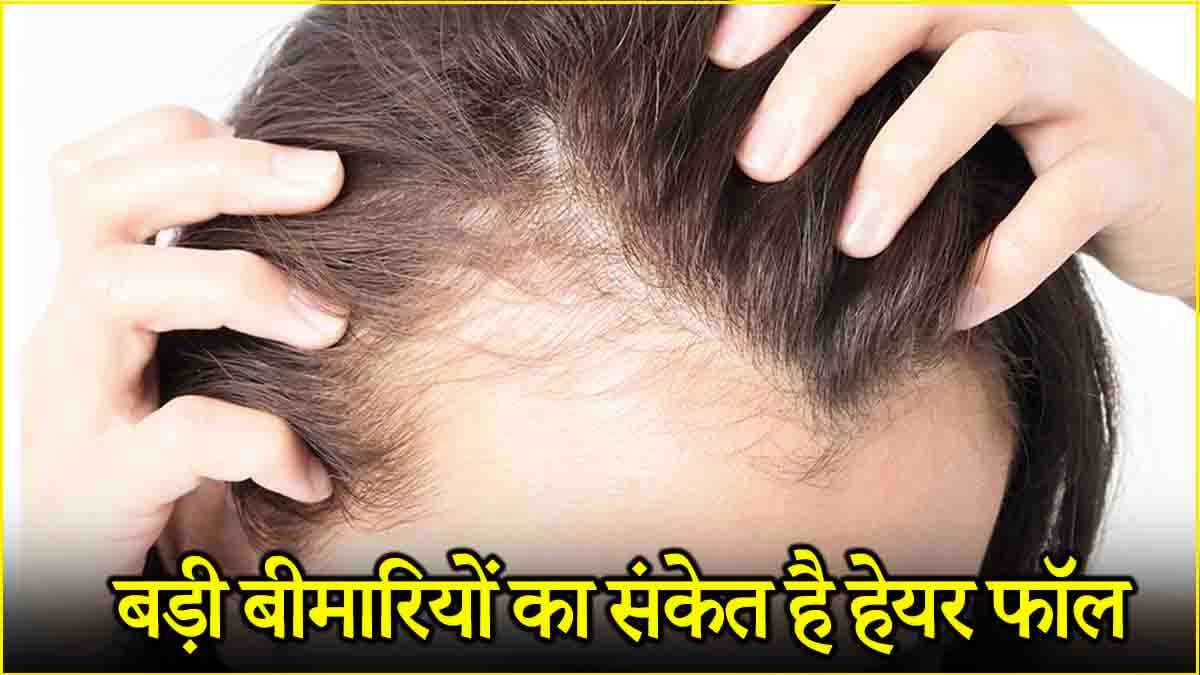 हेयरफॉल को इग्नोर करना पड़ सकता है भारी! जानें किन बीमारियों के हैं शुरुआती संकेत