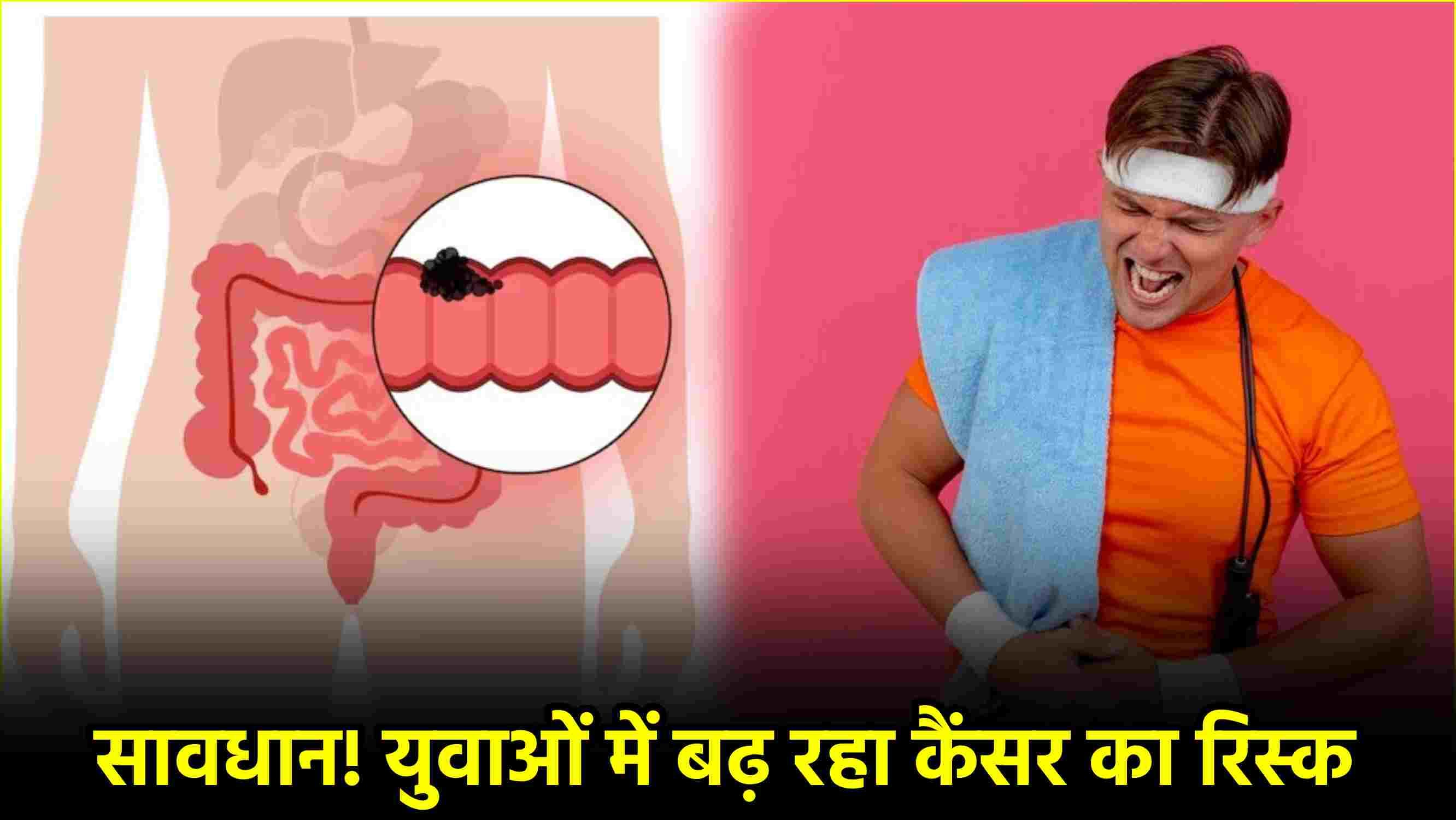 कोलन कैंसर की पहली स्टेज के शुरुआती संकेत क्या? युवाओं में क्यों बढ़ रहे केस