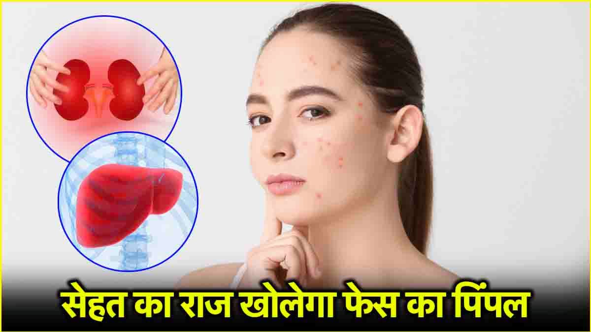Pimple Causes: किडनी से लेकर लिवर तक, पिंपल बताएंगे शरीर के किस अंग में हैं गड़बड़