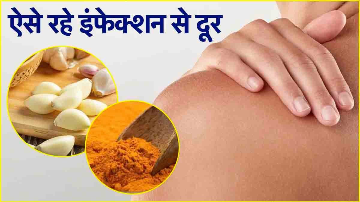 Allergies: हल्दी सहित इन फूड को करें अपनी डाइट में शामिल, एलर्जी से रखेगा दूर