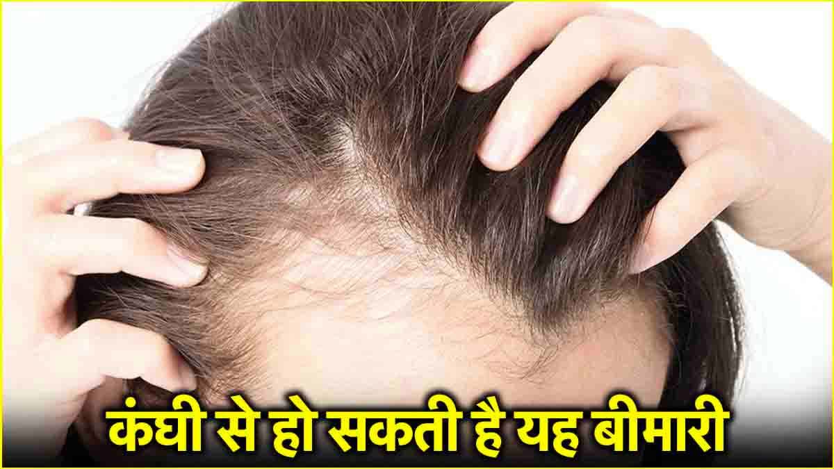 Traction Alopecia: कहीं आप तो नहीं कर रहे गलत तरह से कंघी? जानें लें, हो सकती है ये बीमारी