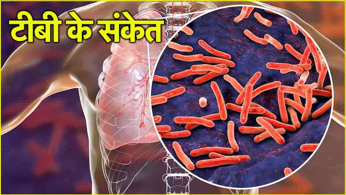 Tuberculosis Symptoms: कोरोना से भी ज्यादा खतरनाक है फेफड़ों की ये बीमारी! जानें शुरुआती संकेत