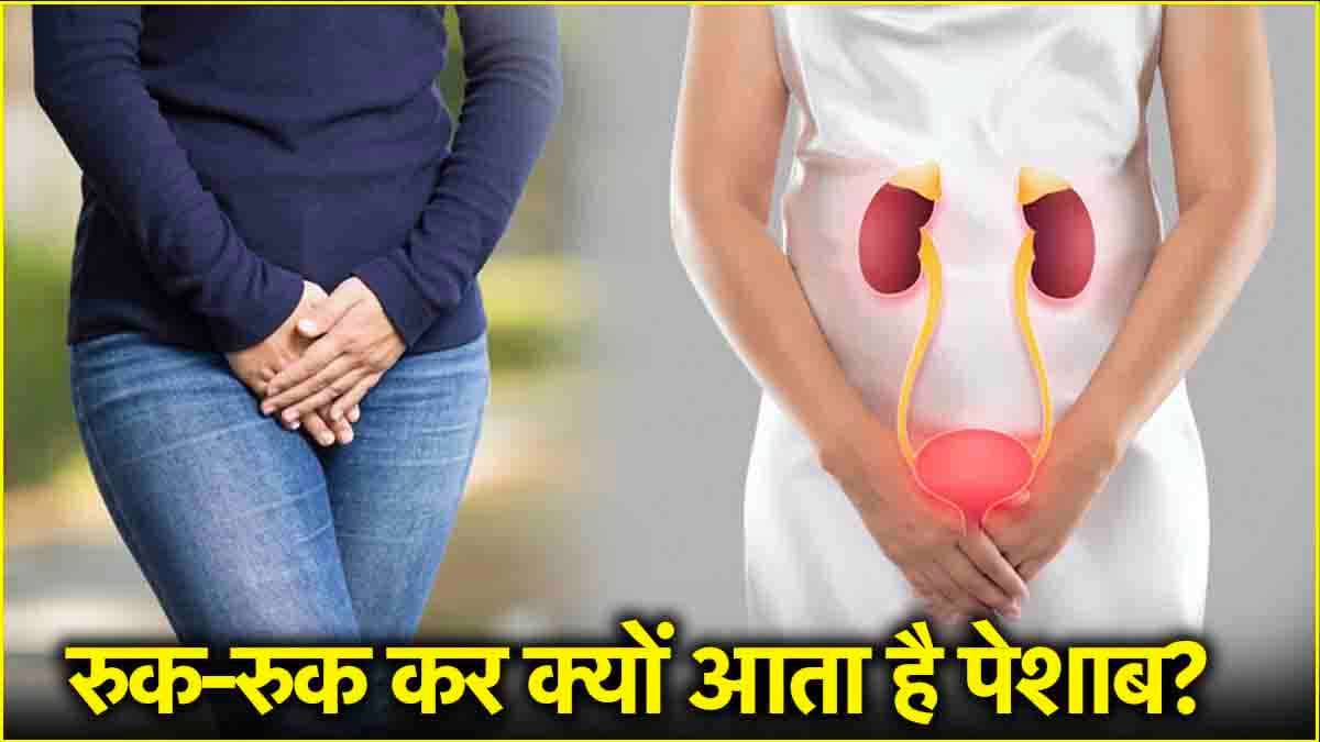 Urine Problems: रुक-रुक कर पेशाब आना गंभीर बीमारी के संकेत, महिलाएं न करें इग्नोर